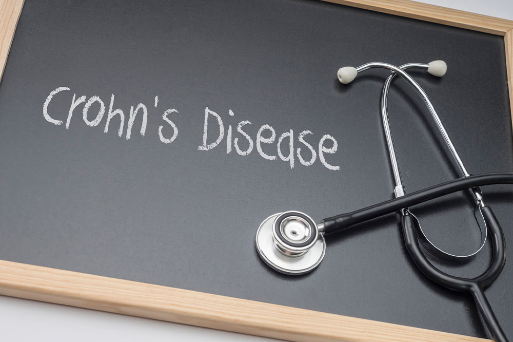 Symptoms, Types, and More About Crohn’s Disease
