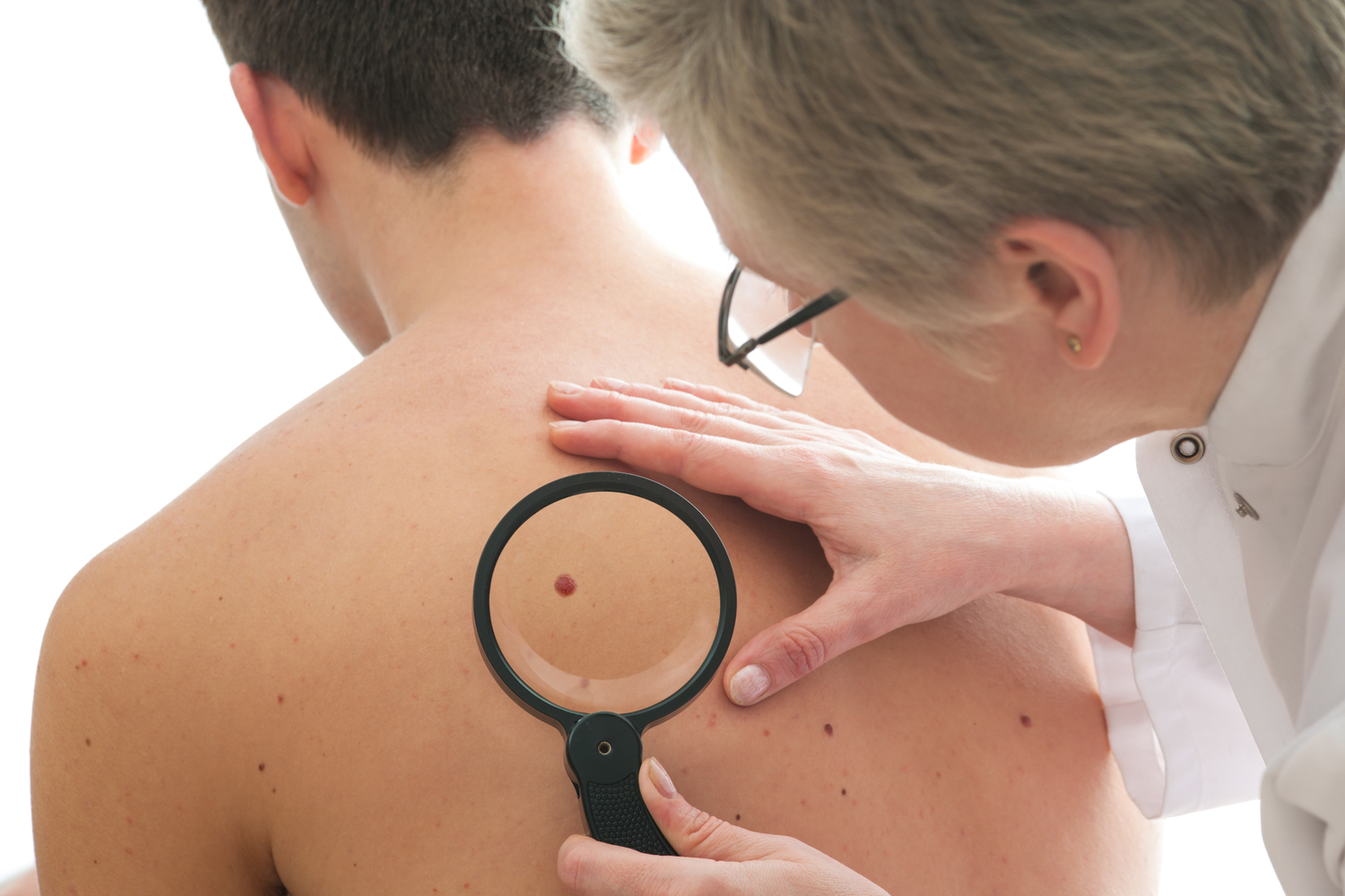 All About Cellulitis – Causes, Symptoms, And Treatment